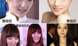 整容女星爆料事件真相视频,背后真相令人震惊